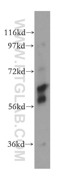CES2 Rabbit anti-Human, Polyclonal, Proteintech:Antibodies:Primary Antibodies