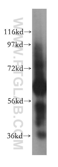 CES2 Rabbit anti-Human, Polyclonal, Proteintech:Antibodies:Primary Antibodies