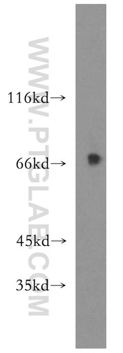 USP2 Rabbit anti-Human, Mouse, Rat, Polyclonal, Proteintech:Antibodies:Primary