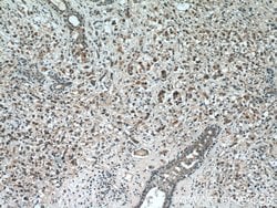 RAB2 Rabbit anti-Human, Mouse, Rat, Polyclonal, Proteintech 150 &mu;L;