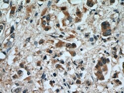 RAB2 Rabbit anti-Human, Mouse, Rat, Polyclonal, Proteintech 150 &mu;L;