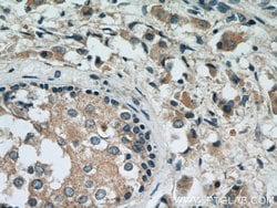 RAB2 Rabbit anti-Human, Mouse, Rat, Polyclonal, Proteintech 150 &mu;L;