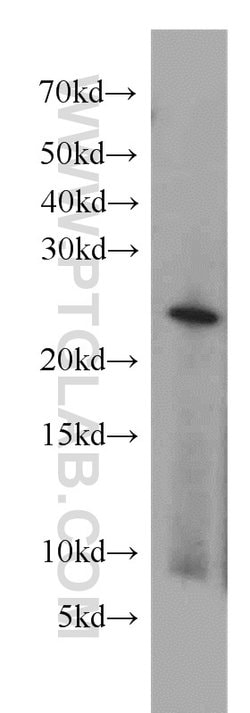 RAB2 Rabbit anti-Human, Mouse, Rat, Polyclonal, Proteintech 150 &mu;L;
