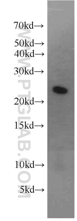 RAB2 Rabbit anti-Human, Mouse, Rat, Polyclonal, Proteintech 150 &mu;L;
