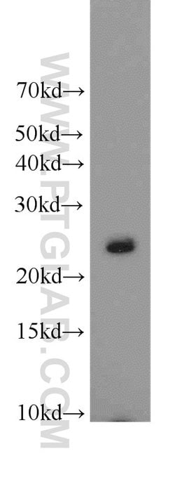 RAB2 Rabbit anti-Human, Mouse, Rat, Polyclonal, Proteintech 150 &mu;L;