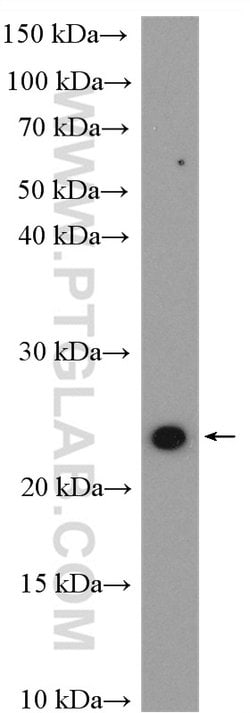 RAB2 Rabbit anti-Human, Mouse, Rat, Polyclonal, Proteintech 150 &mu;L;