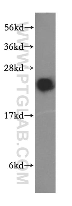 RAB2 Rabbit anti-Human, Mouse, Rat, Polyclonal, Proteintech 150 &mu;L;