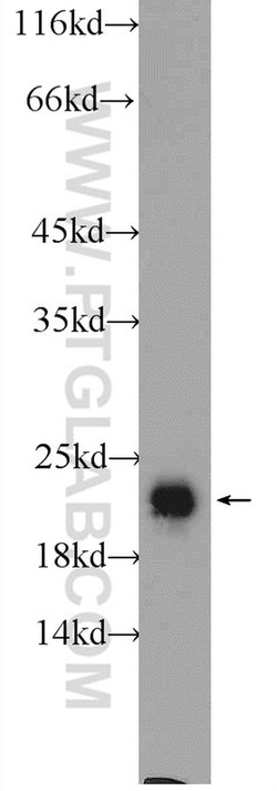 RAB2 Rabbit anti-Human, Mouse, Rat, Polyclonal, Proteintech 150 &mu;L;