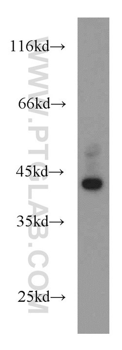 Bif-1 Rabbit anti-Human, Mouse, Rat, Polyclonal, Proteintech 150 &mu;L;