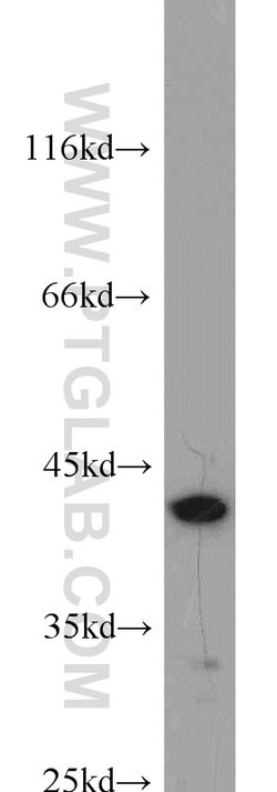 Bif-1 Rabbit anti-Human, Mouse, Rat, Polyclonal, Proteintech 150 &mu;L;