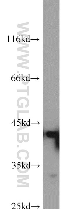 Bif-1 Rabbit anti-Human, Mouse, Rat, Polyclonal, Proteintech 150 &mu;L;
