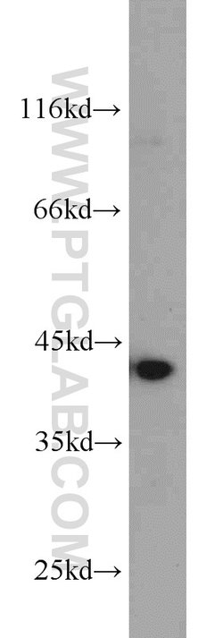 Bif-1 Rabbit anti-Human, Mouse, Rat, Polyclonal, Proteintech 150 &mu;L;