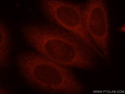 Bif-1 Rabbit anti-Human, Mouse, Rat, Polyclonal, Proteintech 150 &mu;L;