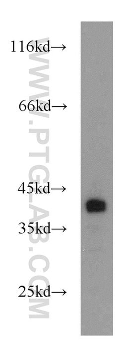 Bif-1 Rabbit anti-Human, Mouse, Rat, Polyclonal, Proteintech 150 &mu;L;
