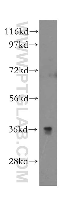 CD300LG Rabbit anti-Human, Polyclonal, Proteintech:Antibodies:Primary Antibodies