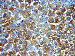 Alpha galactosidase A Rabbit anti-Human, Mouse, Rat, Polyclonal, Proteintech:Antibodies:Primary
