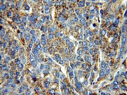 Alpha galactosidase A Rabbit anti-Human, Mouse, Rat, Polyclonal, Proteintech:Antibodies:Primary