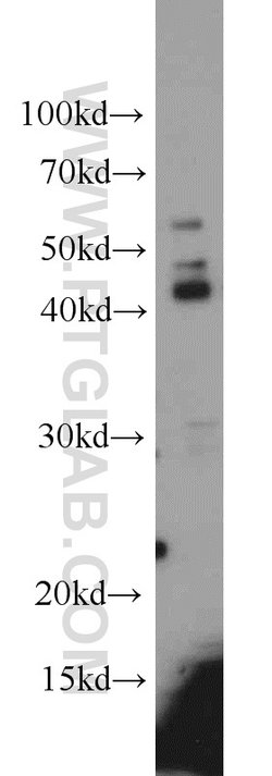 Alpha galactosidase A Rabbit anti-Human, Mouse, Rat, Polyclonal, Proteintech:Antibodies:Primary
