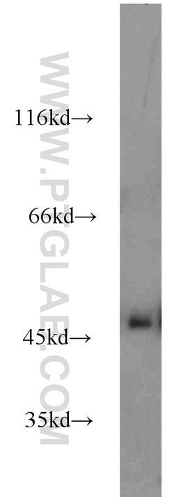 Alpha galactosidase A Rabbit anti-Human, Mouse, Rat, Polyclonal, Proteintech:Antibodies:Primary