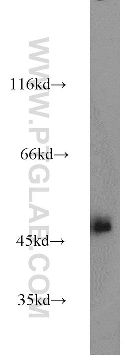 Alpha galactosidase A Rabbit anti-Human, Mouse, Rat, Polyclonal, Proteintech:Antibodies:Primary