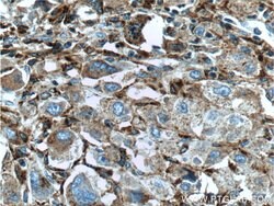 Alpha galactosidase A Rabbit anti-Human, Mouse, Rat, Polyclonal, Proteintech:Antibodies:Primary