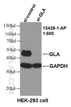 Alpha galactosidase A Rabbit anti-Human, Mouse, Rat, Polyclonal, Proteintech:Antibodies:Primary