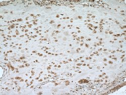 NSUN5 Rabbit anti-Human, Mouse, Rat, Polyclonal, Proteintech:Antibodies:Primary