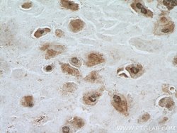 NSUN5 Rabbit anti-Human, Mouse, Rat, Polyclonal, Proteintech:Antibodies:Primary