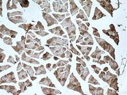 NSUN5 Rabbit anti-Human, Mouse, Rat, Polyclonal, Proteintech:Antibodies:Primary