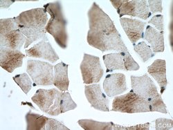 NSUN5 Rabbit anti-Human, Mouse, Rat, Polyclonal, Proteintech:Antibodies:Primary