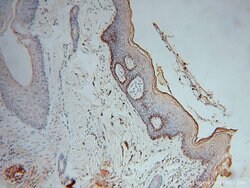 NSUN5 Rabbit anti-Human, Mouse, Rat, Polyclonal, Proteintech:Antibodies:Primary