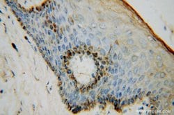 NSUN5 Rabbit anti-Human, Mouse, Rat, Polyclonal, Proteintech:Antibodies:Primary