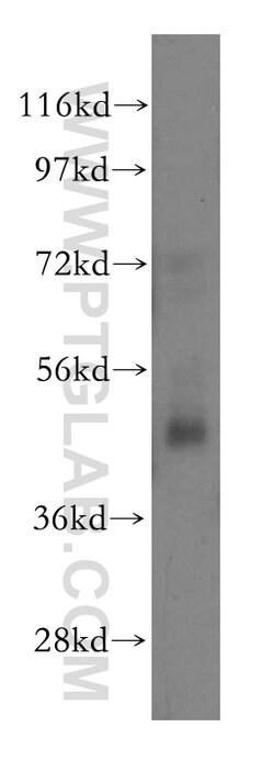 NSUN5 Rabbit anti-Human, Mouse, Rat, Polyclonal, Proteintech:Antibodies:Primary