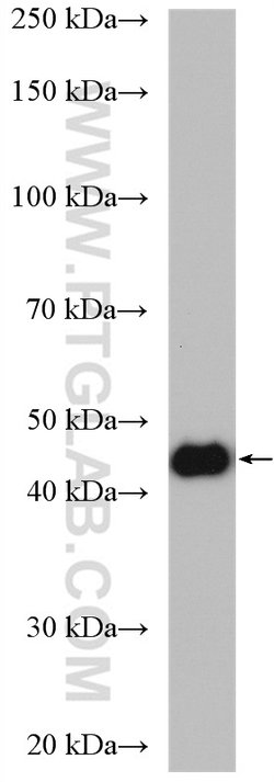 NSUN5 Rabbit anti-Human, Mouse, Rat, Polyclonal, Proteintech:Antibodies:Primary