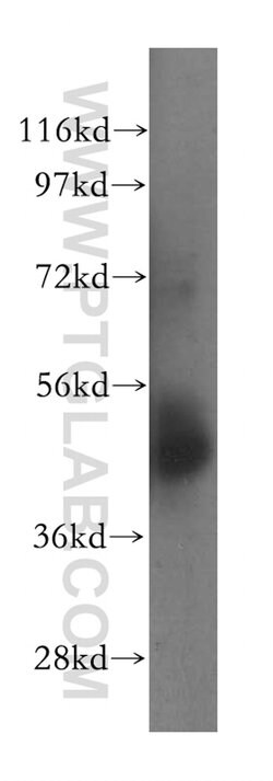 NSUN5 Rabbit anti-Human, Mouse, Rat, Polyclonal, Proteintech:Antibodies:Primary