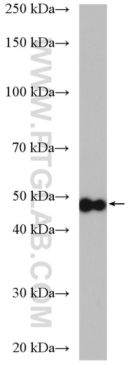 NSUN5 Rabbit anti-Human, Mouse, Rat, Polyclonal, Proteintech:Antibodies:Primary
