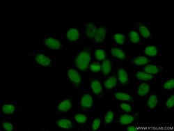 RPP25 Rabbit anti-Human, Mouse, Rat, Polyclonal, Proteintech 150 &mu;L;