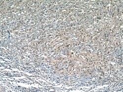 RPP25 Rabbit anti-Human, Mouse, Rat, Polyclonal, Proteintech 150 &mu;L;