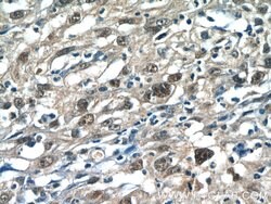 RPP25 Rabbit anti-Human, Mouse, Rat, Polyclonal, Proteintech 150 &mu;L;