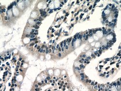 RPP25 Rabbit anti-Human, Mouse, Rat, Polyclonal, Proteintech 150 &mu;L;