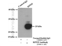 RPP25 Rabbit anti-Human, Mouse, Rat, Polyclonal, Proteintech 150 &mu;L;
