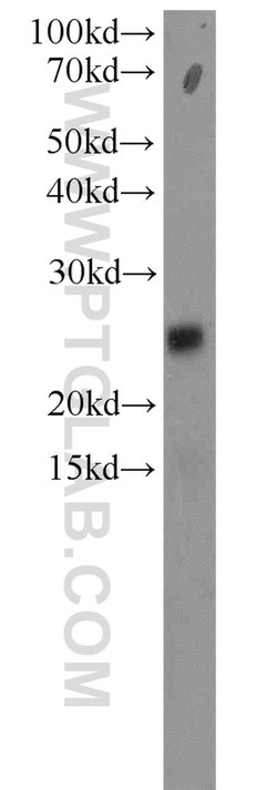 RPP25 Rabbit anti-Human, Mouse, Rat, Polyclonal, Proteintech 150 &mu;L;