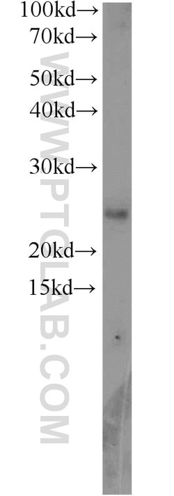 RPP25 Rabbit anti-Human, Mouse, Rat, Polyclonal, Proteintech 150 &mu;L;