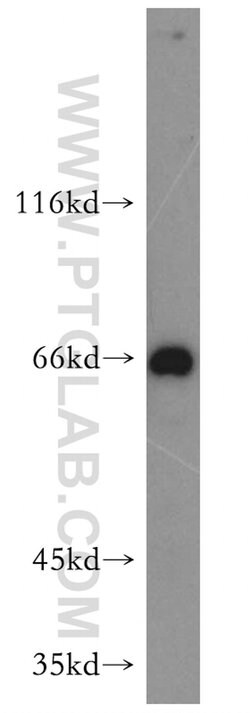 MAPKAP1 Rabbit anti-Human, Mouse, Rat, Polyclonal, Proteintech:Anticuerpos:Anticuerpos