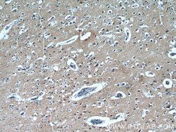 LIMD2 Rabbit anti-Human, Mouse, Rat, Polyclonal, Proteintech:Antibodies:Primary