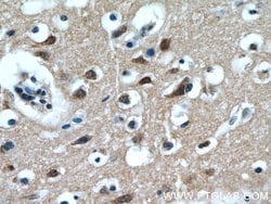 LIMD2 Rabbit anti-Human, Mouse, Rat, Polyclonal, Proteintech:Antibodies:Primary