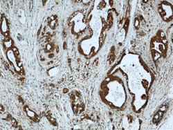 LIMD2 Rabbit anti-Human, Mouse, Rat, Polyclonal, Proteintech:Antibodies:Primary