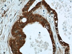 LIMD2 Rabbit anti-Human, Mouse, Rat, Polyclonal, Proteintech:Antibodies:Primary