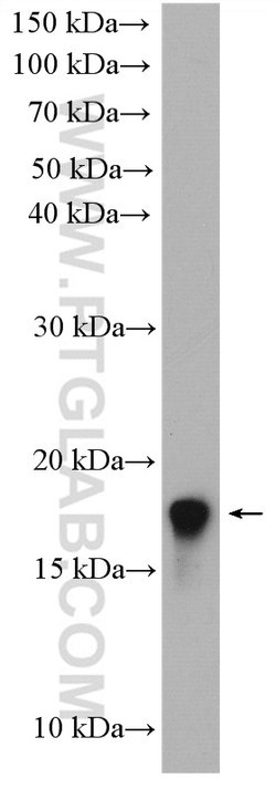 LIMD2 Rabbit anti-Human, Mouse, Rat, Polyclonal, Proteintech:Antibodies:Primary