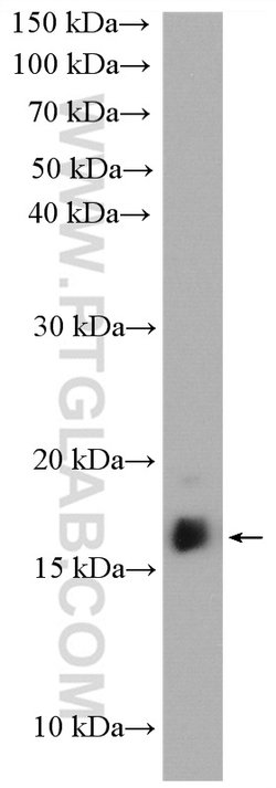 LIMD2 Rabbit anti-Human, Mouse, Rat, Polyclonal, Proteintech:Antibodies:Primary